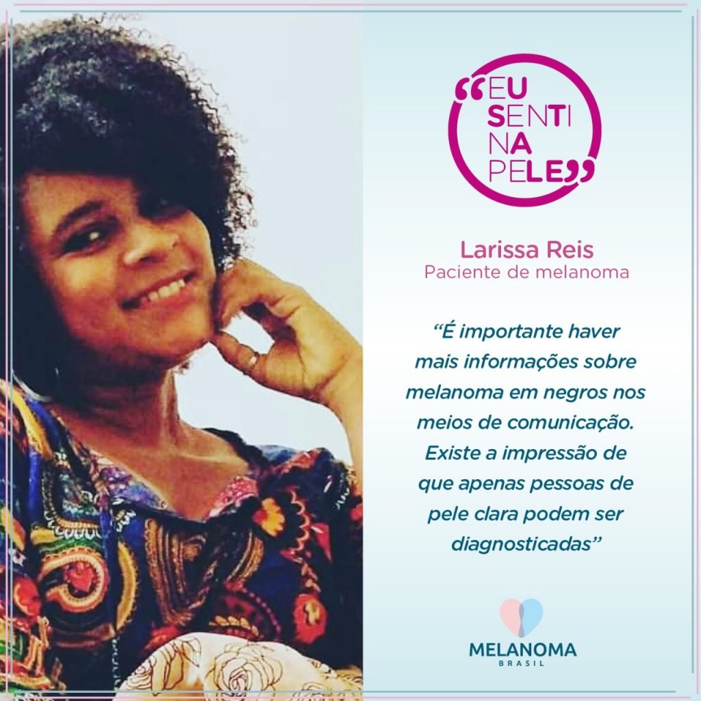 Larissa Reis, paciente de melanoma, não imaginava que pessoas negras pudessem ser diagnosticadas