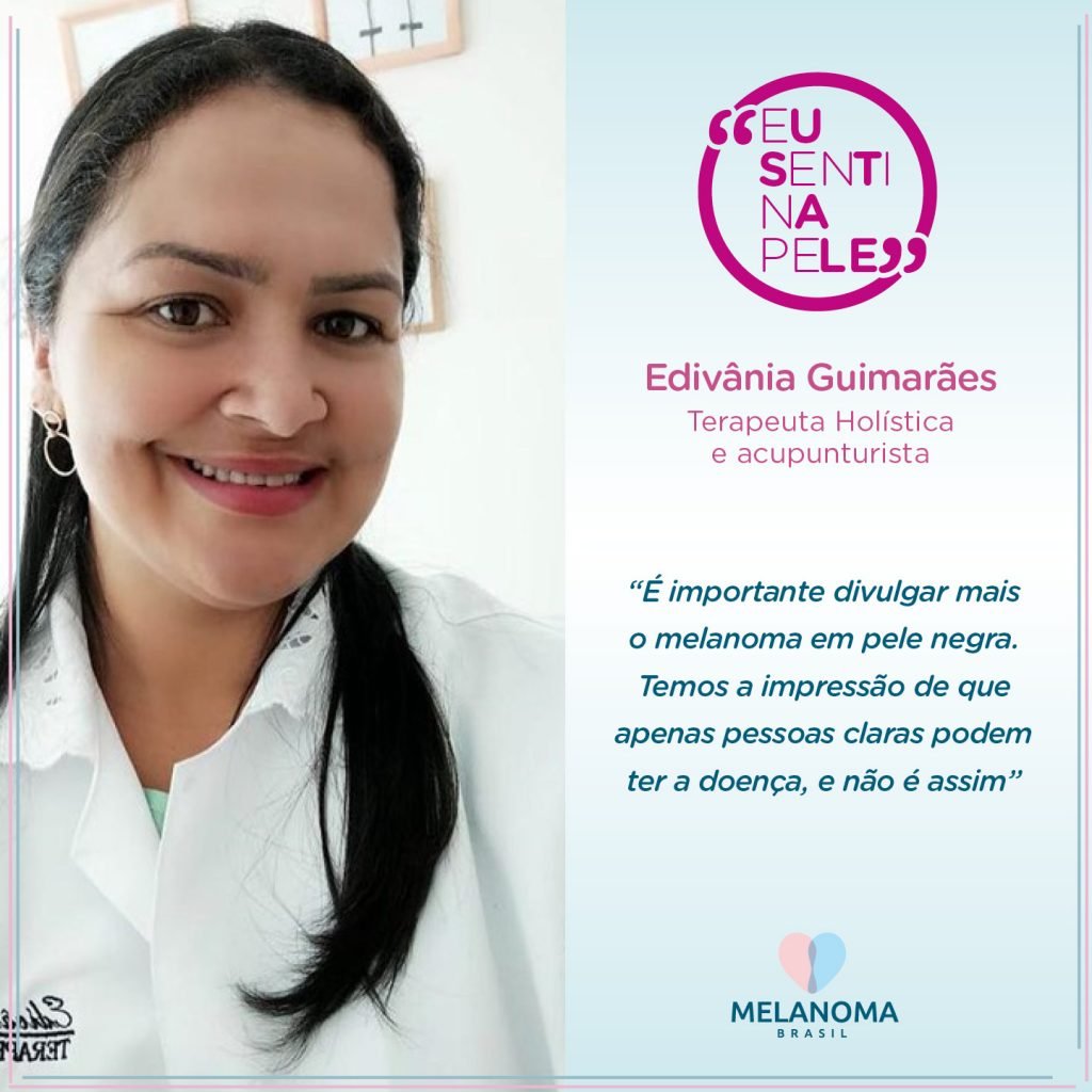 A acupuntirista e terapeuta holística Edivânia Guimarães afima: o melanoma não faz distinção.