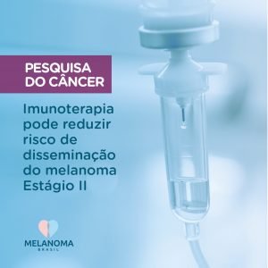 Imunoterapia pode reduzir risco de disseminação do melanoma Estágio II