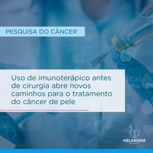 Pacientes de câncer de pele carcinoma espinocelular podem se beneficiar com o imunoterápico cemiplimabe como terapia neoadjuvante.