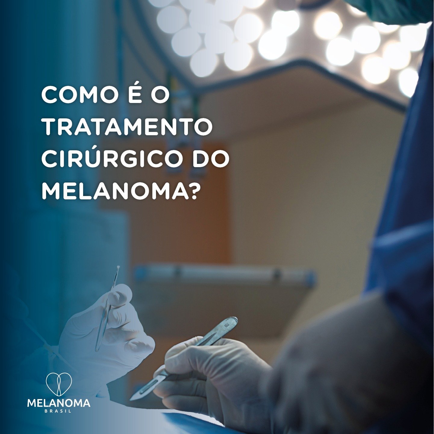 Como é o tratamento cirúrgico do melanoma? • Instituto Melanoma Brasil