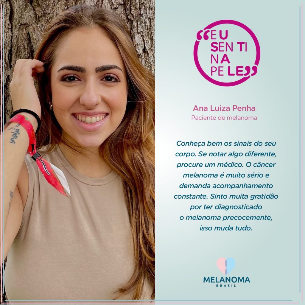 A administradora Ana Luiza Penha viveu o desafio de descobrir um melanoma extensivo superficial com apenas 23 anos.